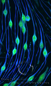 Dworski - Schwann cells - watermark Dworski - Schwann cells - watermark